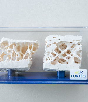 骨粗鬆症専門クリニック・エビデンスに基づいて治療